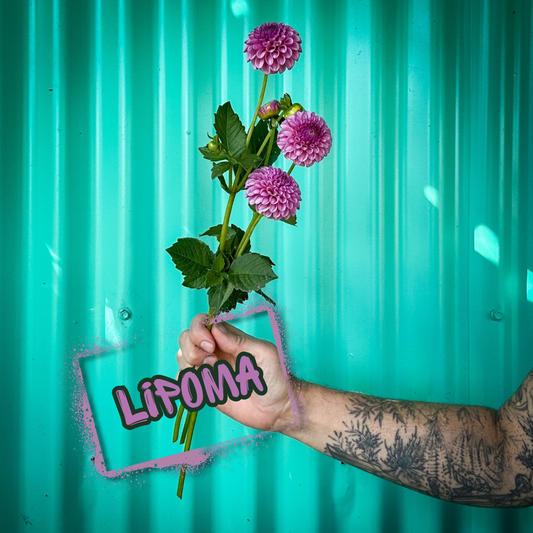 Lipoma Dahlia Tuber